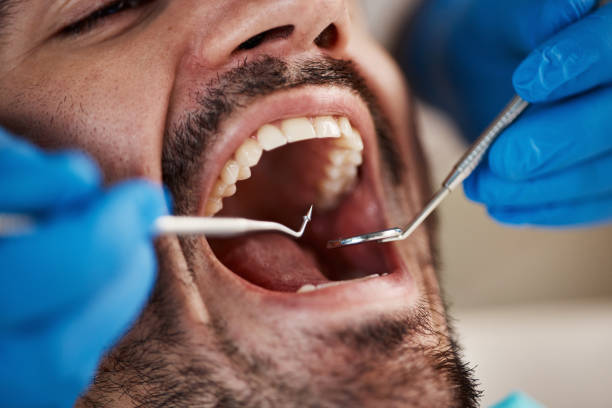 Best After-Hours Emergency Dentist in Franklin, MI